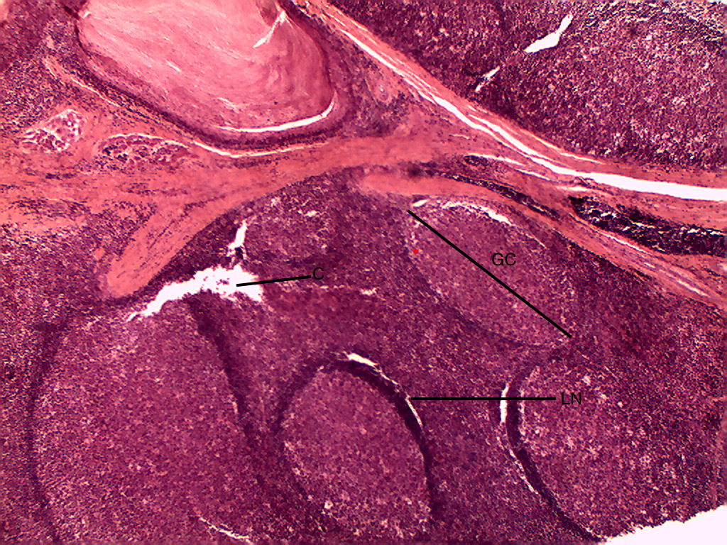 Pharyngeal Tonsil Histology